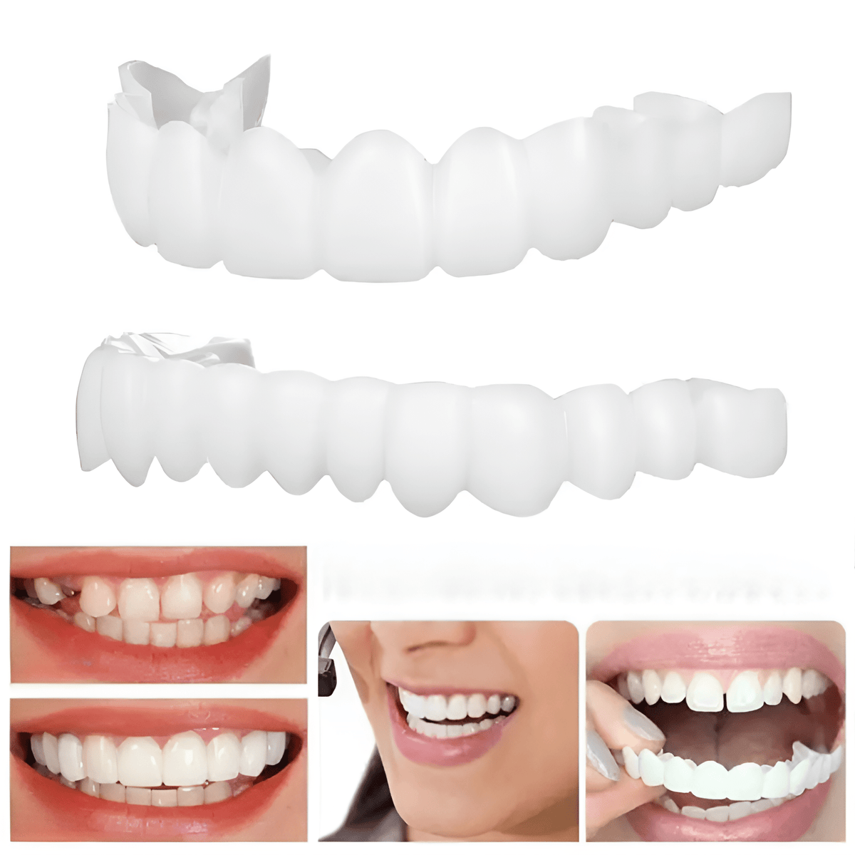 Facetas Dentárias DentalLux | Sorriso Perfeito Sem Dor Nem Dentista - Loja Confia